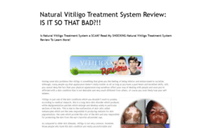 Naturalvitiligotreatmentsystemsreview.blogspot.com thumbnail