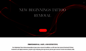 Newbeginningstattooremoval.com thumbnail