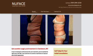 Nufacelaserandvein.com thumbnail