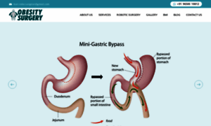 Obesity-surgery.in thumbnail