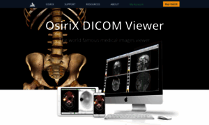 Osirix-viewer.com thumbnail
