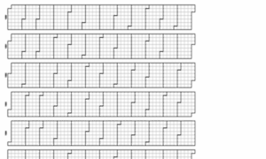 P5lz8vv49q.codesandbox.io thumbnail