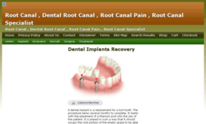 Painafterrootcanalguide.net thumbnail