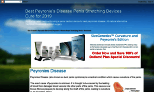 Peyroniesdevices.blogspot.com thumbnail