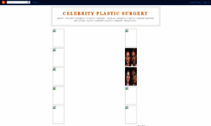 Plastic-celebritysurgery.blogspot.com thumbnail