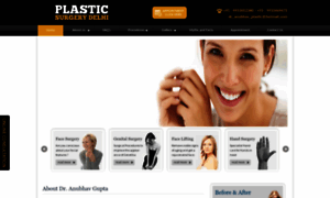 Plasticsurgerydelhi.in thumbnail