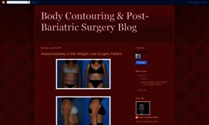 Post-bariatric-plastic-surgery.blogspot.com thumbnail