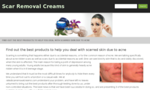 Ratedscarremovalcreams.com thumbnail