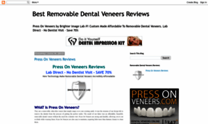 Removabledentalveneers.blogspot.com thumbnail