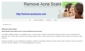 Remove-acnescars.com thumbnail