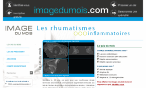 Rhumatismes.imagedumois.com thumbnail