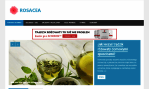 Rosacea.net.pl thumbnail