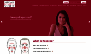Rosacea.org thumbnail