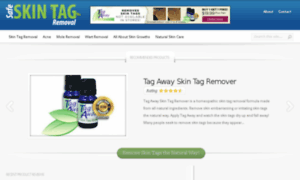 Safe-skin-tag-removal.com thumbnail