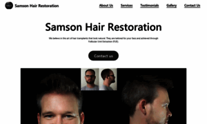 Samson-hair-restoration.biz.site thumbnail
