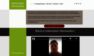 Seborrheic-dermatitis.net thumbnail