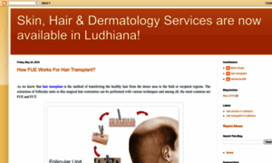 Skinhairdermatologyservicesludhiana.blogspot.com thumbnail