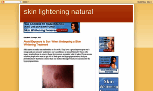 Skinlighteningnatural.blogspot.com thumbnail