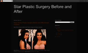 Starplasticsurgery.blogspot.com thumbnail