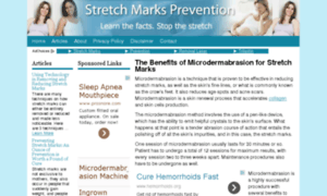 Stretch-marks-prevention.com thumbnail