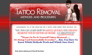 Tattoo-removal-methods-and-procedures.com thumbnail