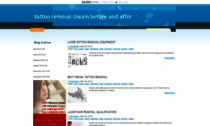 Tattooremovalcreambeforeandafter.blogspot.com thumbnail