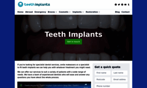 Teeth-implants.co.uk thumbnail