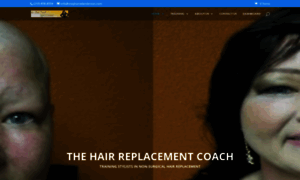 Thehairreplacementcoach.com thumbnail