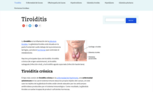 Tiroiditis.net thumbnail