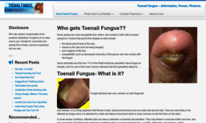 Toenailfungus.org thumbnail
