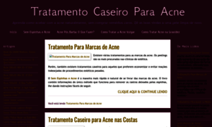 Tratamentocaseiroparaacne.blogspot.com thumbnail