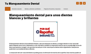 Tublanqueamientodental.com thumbnail