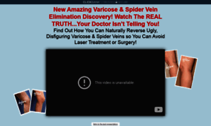 Varicose-veins-natural-treatment.com thumbnail