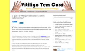 Vitiligotemcura.com thumbnail